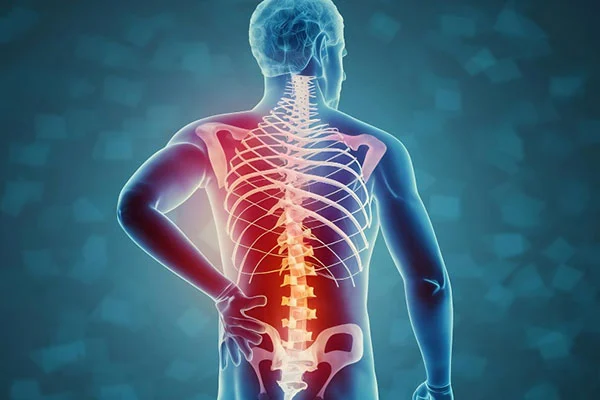 spinal-tuberculosis-treatment-in-lucknow